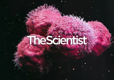 A Spotlight on Cancer Cell Metabolism